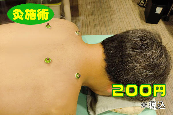 灸施術　２００円